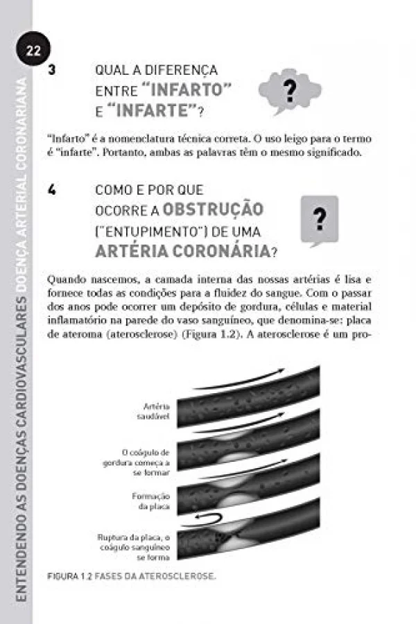 Entendendo as Doenas Cardiovasculares