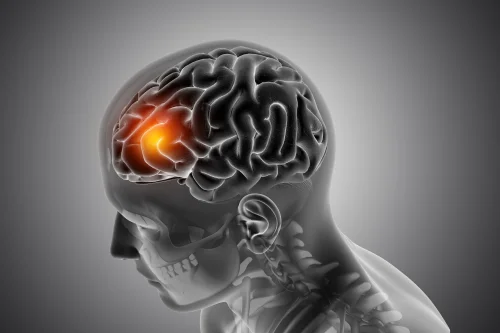 Diretrizes da  Sociedade Brasileira de Angiologia e Cirurgia Vascular para o tratamento da doen�a cerebrovascular  extracraniana