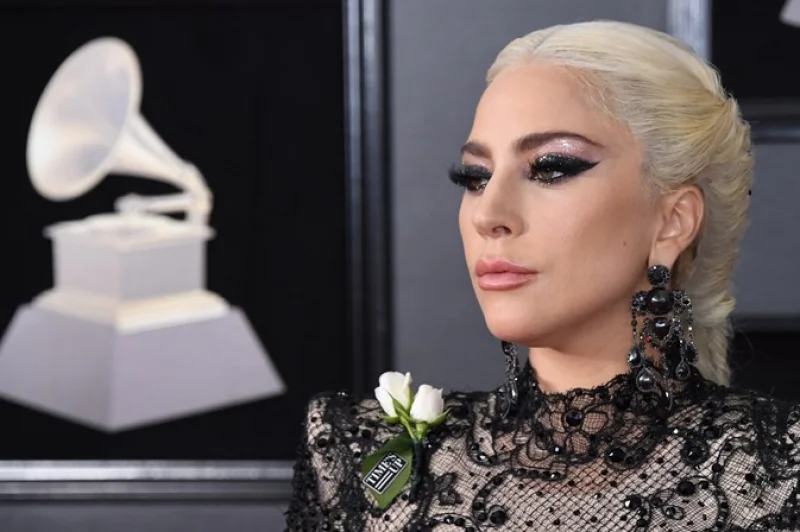 Lady Gaga cancela shows na Europa devido a fortes dores