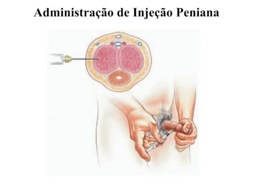 Quando o Viagra� n�o funciona!?