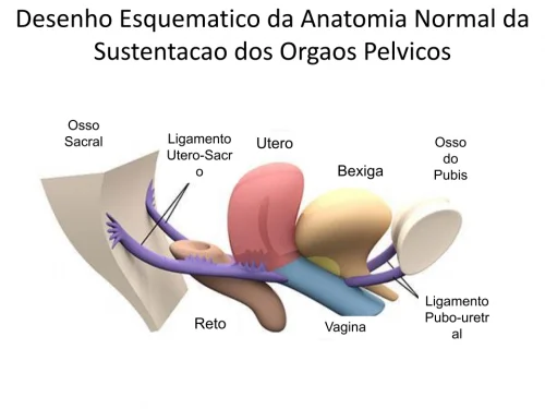 Tratamento Cir�rgico da Urg�ncia Miccional e da Incontin�ncia Urin�ria em Mulheres � CESA-VASA