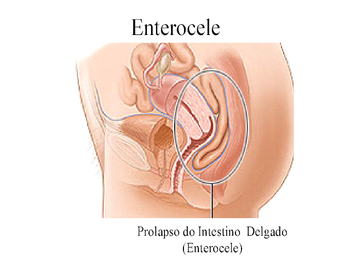 Cirurgia �ntima Feminina