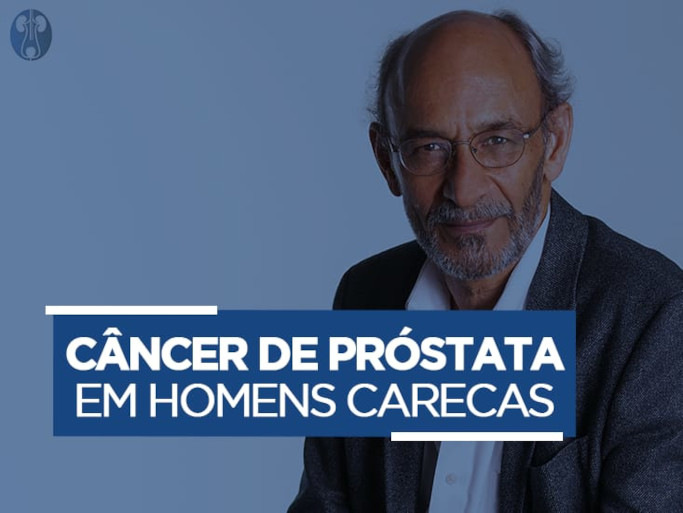 Fertilidade Masculina Varicocele Testosterona e Calv�cie