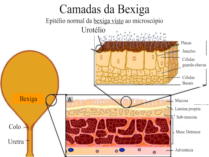 Dor P�lvica Cr�nica, Bexiga Dolorosa e Dor na Rela��o